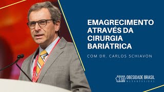 Minha vida após a cirurgia bariátrica