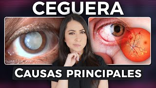 Causas Principales De Ceguera