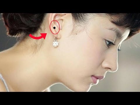 Nốt ruồi ở tai cho biết điều gì về bạn?