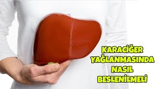 Karaciğer Yağlanmasında Nasıl Beslenilmeli?