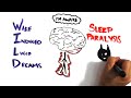 dreaming
