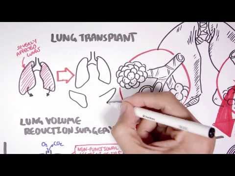 dosage of prednisone for dogs with lymphoma dosage of prednisone for dogs with lymphoma