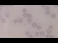Mycoplasma haemofelis. CIAB. www.ciab.es.
