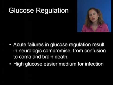 Hyperglycmia DKA Diabetic Ketoacidosis Sliding Scale Insulin