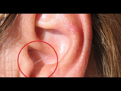EAR HAIR IS THE FIRST WARNING SIGN OF THE MOST DANGEROUS DISEASE IN THE 21ST CENTURY