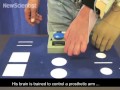 Bionic arm trumps flesh after elective amputation