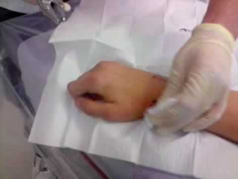 My+Penectomy+Photo My Penectomy Photo Httpcobmtribenetphotos69cc27b4 7945 477a Pictures