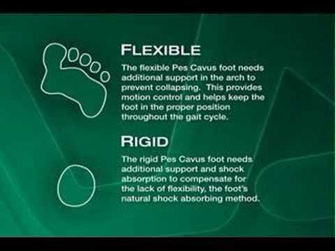 Plantar Fasciitis,Pes Planus,Mallet Toe,High Arched Feet,Heel Spur,Heel Pain,Hammer Toe,Hallux Valgus,Foot Pain,Foot Hard Skin,Foot Conditions,Foot Callous,Flat Feet,Fallen Arches,Diabetic Foot,Contracted Toe,Claw Toe,Bunions Hard Skin,Bunions Callous,Bunion Pain,Ball Of Foot Pain,Back Pain