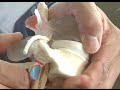 Help For A Herniated Disk