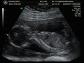 16 week 6 day ultrasound .....it's a boy