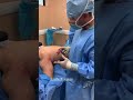 Male Makeover Surgery - Lipo Etching - Fat Grafting - Pectoral Implants