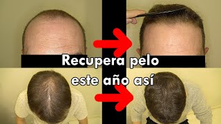 Estrategia de recuperación de pelo en 1 año