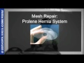 Inguinal hernias.flv