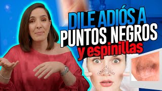 ESPINILLAS ¿Como evitarlas? Dra Pilar Ochoa - Dermatologa