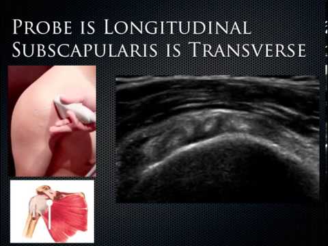 12 MSK Anatomical Ultrasound of Shoulder,knee,hand - YouTube