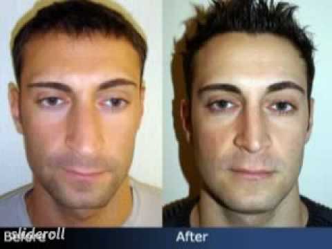 New York Nose and Rhinoplasty Expert Dr. Sam Rizk is a pioneer for various 