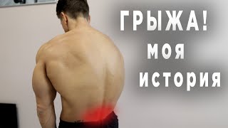 Обнаружили Поясничную Грыжу! Моя История + Комплекс