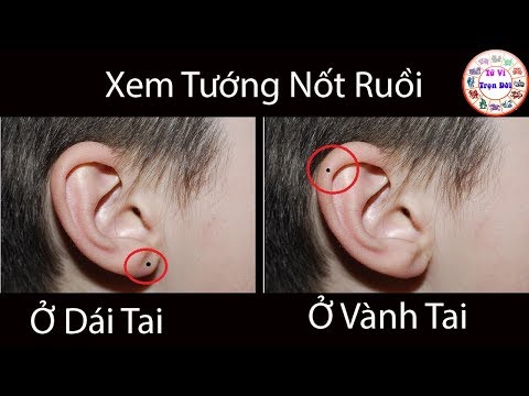 Xem Bói Nôt Ruồi: Nốt Ruồi Ở Tai Là Phúc Hay Họa ? Vị Trí Thứ 6 Cực Hiếm Tử Vi Trọn Đời