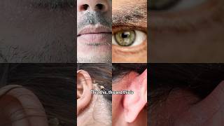 Is It Just Dry Skin Or Seborrheic Dermais?