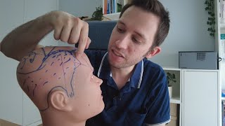 Recuperar PELO en TRIANGULO TEMPORAL (triángulo masculino)