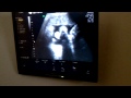 Mason Alexander_34 Weeks 3 Days Sonogram