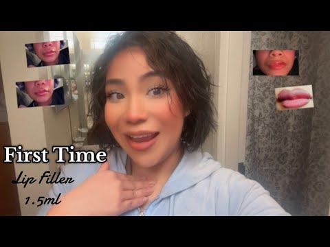 Join me Kimomme as we get lip fillers for the first time.