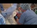 Gentle Cesarean Section Video - Brigham and Women's Hospital Gentle Cesarean Section Video - Brigham and Women's Hospital