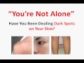How to Get Rid of The Dark Spots on Skin