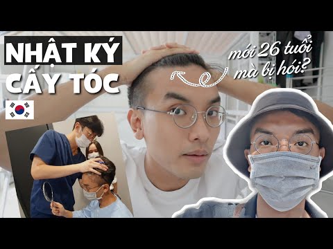Mới 26 tuổi mà bị hói nên phải đi CẤY TÓC ở Hàn Quốc?? | Tập 1: Ngày Phẫu Thuật