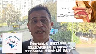 Tükürük Bezi Taşları İlaçsız Tedavi Edilebilir Mi?