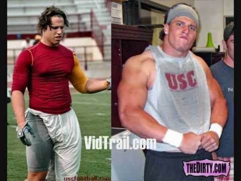 Brian Cushing before and after drug abuse.