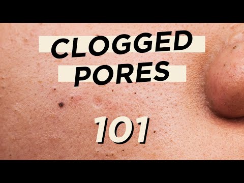 ð¤­Everything you need to know about CLOGGED PORES â¢ Skincare & makeup products are not the culprit - YouTube