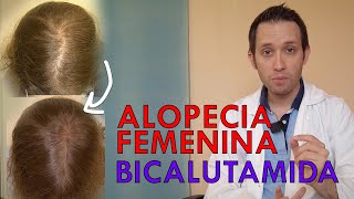 NOVEDAD TRATAMIENTO ALOPECIA MUJER: BICALUTAMIDA