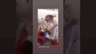 Ahmedkanaanefesol İnstagram Mülteci Diye Ilacı Karşılanmayan Sma Tip-1 Hastası Ahmedi Yaşatalım