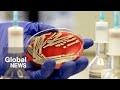 E. coli outbreak: How to protect yourself from bacteria, infection?