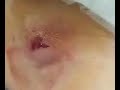 armpit shaving