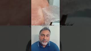 Are Gelatin Face Masks A Game Changer? Doctor Reacts.