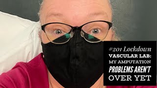 Lock Down Vascular Lab My Amputee Problems Arent Over Yet.