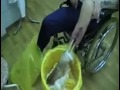 Graphic effects of NEW DRUG! Krokodil rots flesh off bones! aka crocodile !