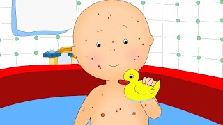 NEW! Caillou gets Chicken Pox | Fun for Kids | s for Toddlers |  Episode | Carto