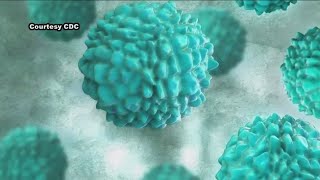 Norovirus cases on the rise. How to protect yourself