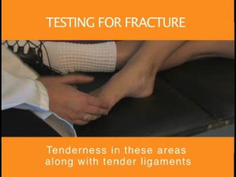 Ottawa Ankle rules by St Joseph's Family Medicine Residency