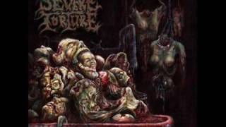 Watch Severe Torture Grave Condition video