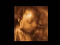 ultrasound 3d 4d