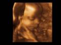 ultrasound 3d 4d