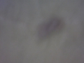 Morgellons thrip larvae on cannabis