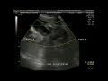 ultrasound 3d 4d