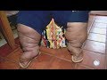 Conheça a vida do adolescente mais obeso do Brasil