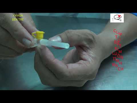 CLIP TỰ ĐẶT KIM LUỒN TĨNH MẠCH