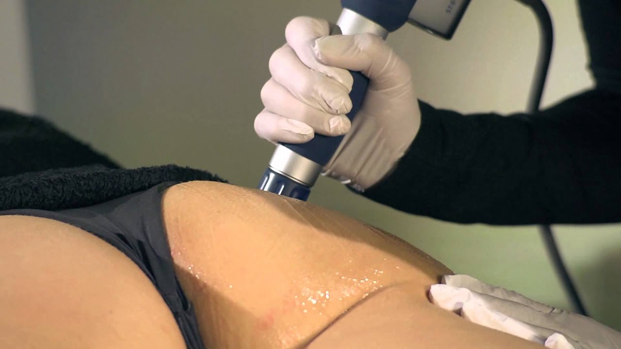 lymfedrainage na liposuctie